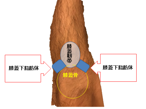 膝の前面痛は膝蓋下脂肪体が原因 日本慢性痛改善協会